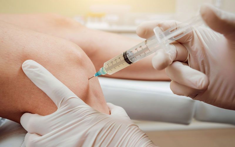 Hyaluronsäuretherapie